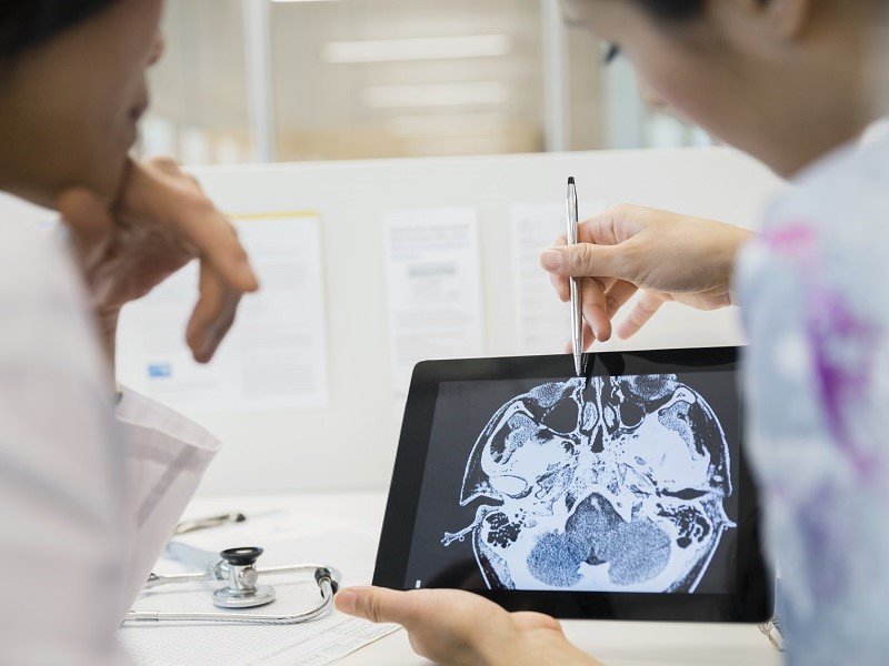 Doctors discussing and study about brain scan on the digital tablet